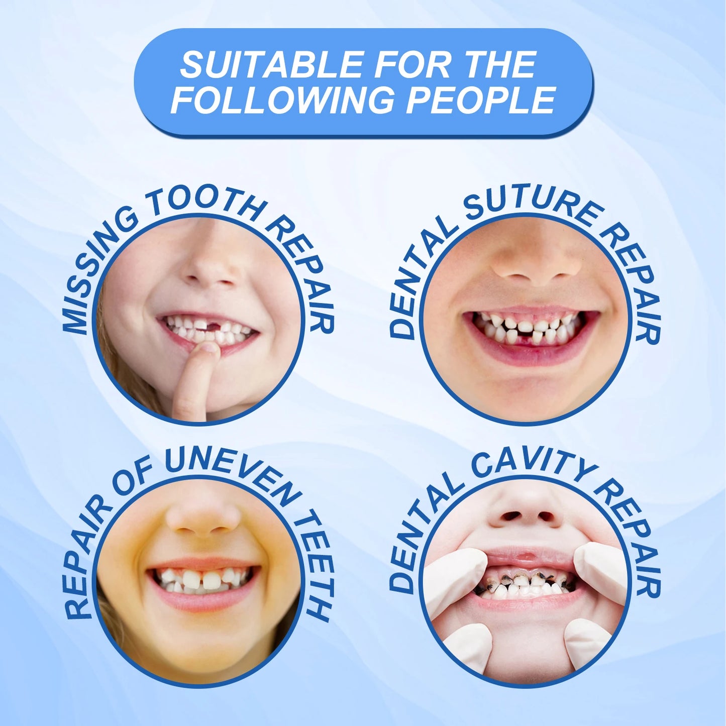Resin Temporary Tooth Repair Granules