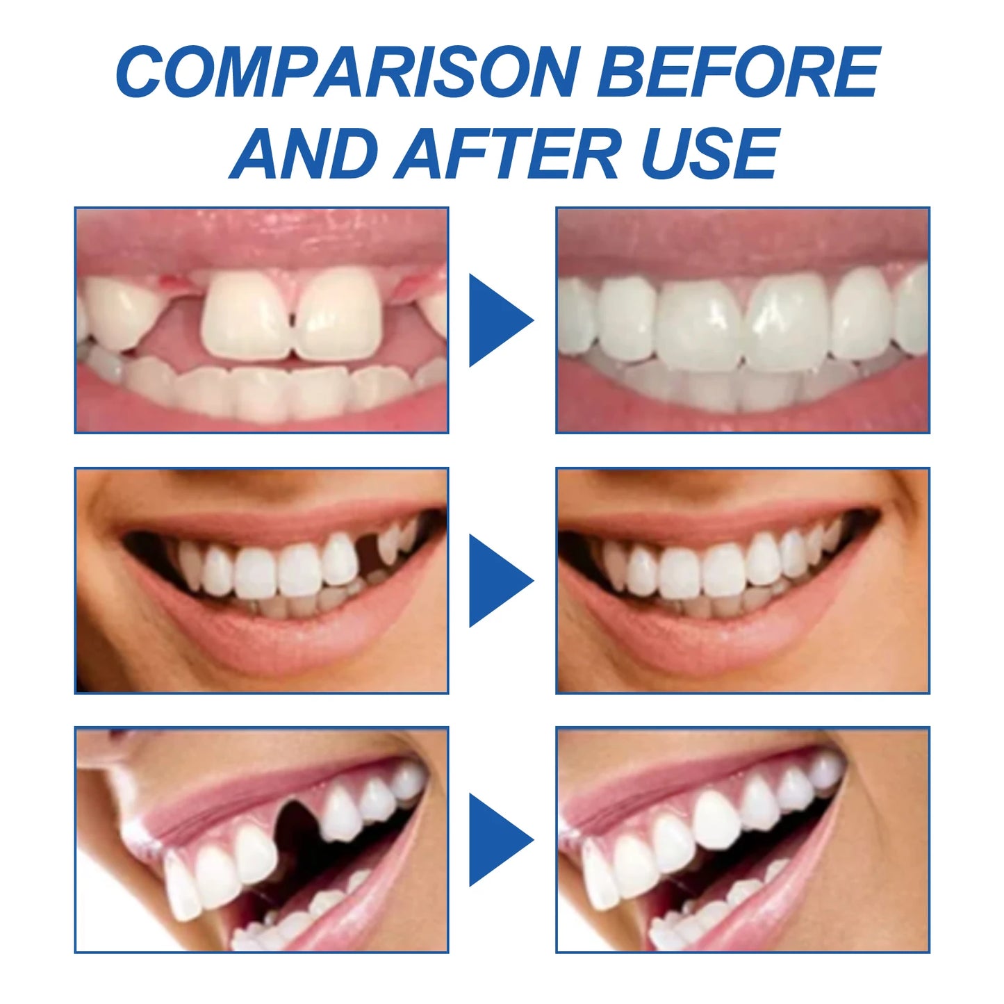 Resin Temporary Tooth Repair Granules