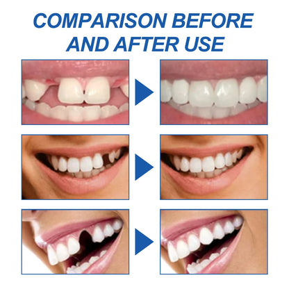 Resin Temporary Tooth Repair Granules